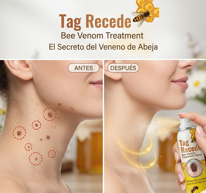 CONTROLA ESAS MOLESTAS VERRUGAS CON TAG RECEDE + ENVÍO GRATIS
